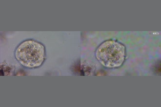 a thumdnail for published video. This is a sample ciliate video