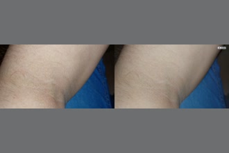 a thumdnail for published video. arm