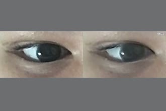 a thumdnail for published video. Eye twitching