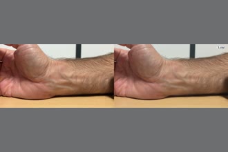 a thumdnail for published video. Arm Stable Camera
Motion 0.8 1.7Hz