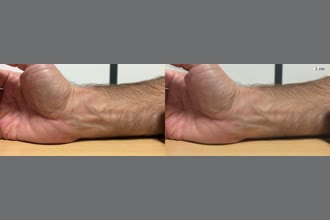 a thumdnail for published video. Arm Stable CAmera
Motion 0.1 - 3.0 Hz