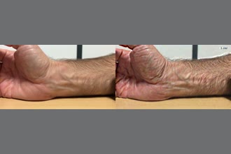 a thumdnail for published video. Arm with stable camera