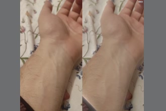 a thumdnail for published video. hand vein